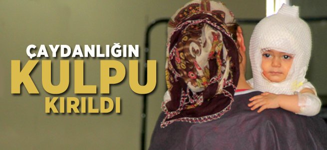 Çaydanlığın Kulpu Kırıldı